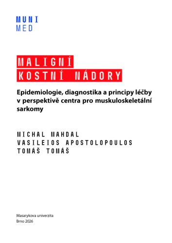 Maligní kostní nádory