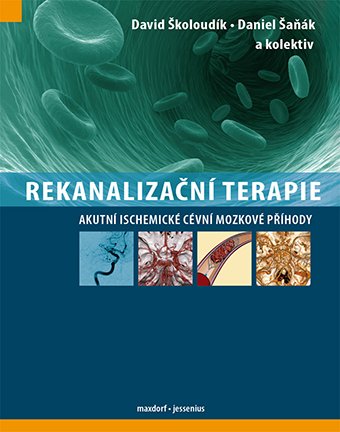 Rekanalizační terapie akutní ischemické cévní mozkové příhody v nestandardních situacích