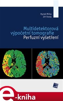 Multidetektorová výpočetní tomografie - Hynek Mírka, Jiří Ferda