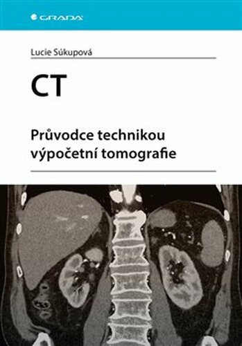 CT - Průvodce technikou výpočetní tomografie