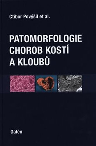 Patomorfologie chorob kostí a kloubů - Ivo Mařík, Alena Maříková, Martin Horák, Ctibor Povýšil