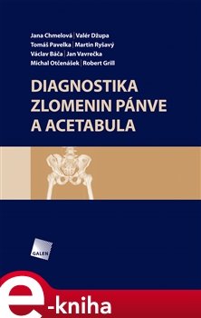 Diagnostika zlomenin pánve a acetabula - Martin Ryšavý, Jana Chmelová, Valér Džupa, Tomáš Pavelka