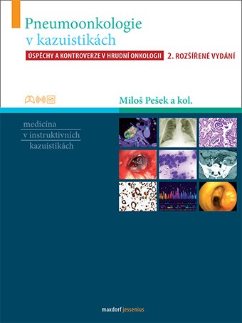 Pneumoonkologie v kazuistikách, 2. rozšířené vydání
