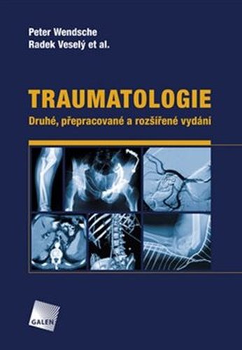 Traumatologie - Peter Wendsche, Radek Veselý, kol.
