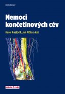 Nemoci končetinových cév - Karel Roztočil, Jan Piťha a kol.