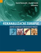 Rekanalizační terapie akutní ischemické cévní mozkové příhody v nestandardních situacích