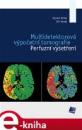 Multidetektorová výpočetní tomografie - Hynek Mírka, Jiří Ferda