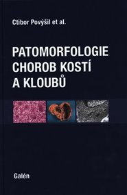 Patomorfologie chorob kostí a kloubů - Ivo Mařík, Alena Maříková, Martin Horák, Ctibor Povýšil