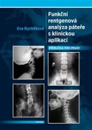 Funkční rentgenová analýza páteře s klinickou aplikací - Eva Rychlíková
