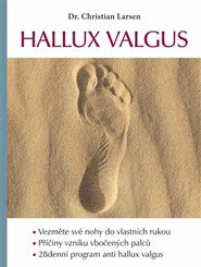 Hallux valgus - Christian Larsen